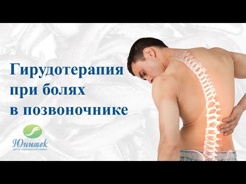 Видео: Гирудотерапия при болях в позвоночнике