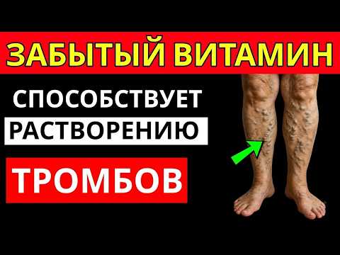 Видео: Эта ВИТАМИНА растворяет тромбы в ногах – Врачи советуют после 40!