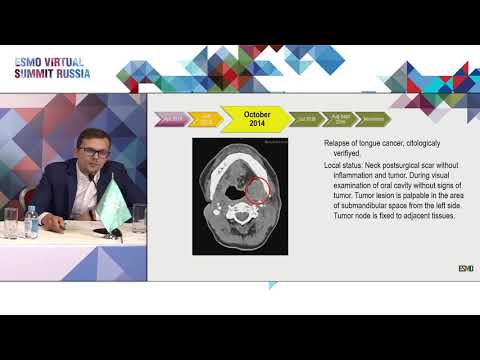 Видео: Плоскоклеточный рак опухолей головы и шеи. Клинический случай 1