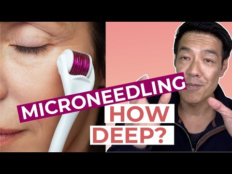 Видео: Микронидлинг в домашних условиях: насколько глубоко следует вводить? | Объясняет доктор Дэвин Лим