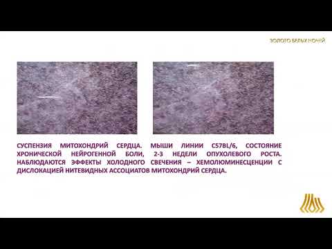Видео: Митохондриальная дисфункция сердца при росте меланомы в эксперименте (Нескубина И.В.)