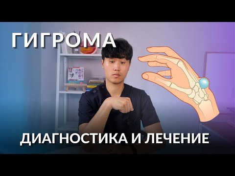 Видео: Гигрома | Диагностика, лечение