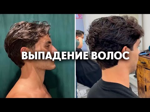 Видео: как реально победить выпадение волос у мужчин