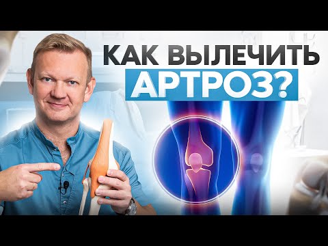 Видео: Лечение артроза дома: 7 проверенных методов восстановления коленей! Даже капустой можно?