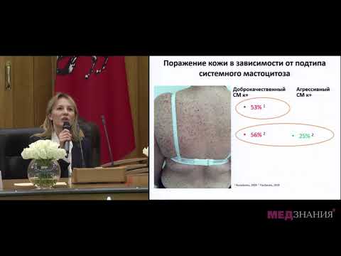 Видео: 11. Кожные проявления мастоцитоза. Алгоритм диагностики и терапии. П.М. Пятилова