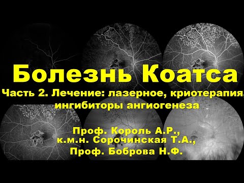 Видео: Болезнь Коатса. Часть вторая. Лечение