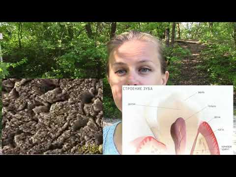Видео: Реальные причины кариеса - об этом не знает никто!