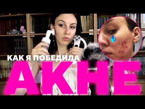Видео: АСМР Как я победила АКНЕ