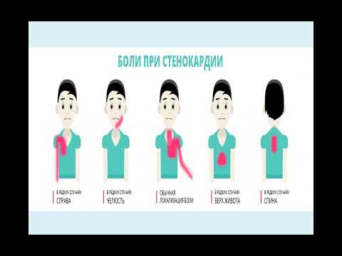 Видео: Синдром коронарной недостаточности