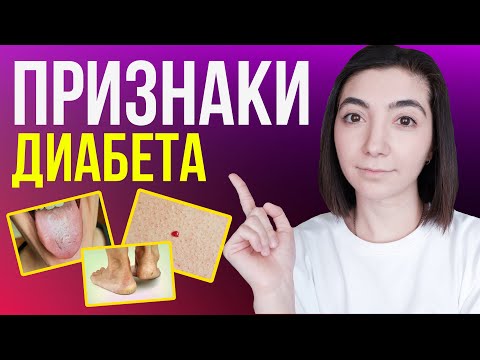 Видео: Как Выявить и НАВСЕГДА ВЫЛЕЧИТЬ Сахарный Диабет!