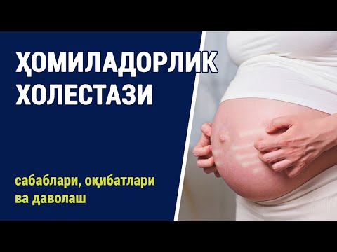 Видео: Ҳомиладорлик холестази: сабаблари, оқибатлари ва даволаш