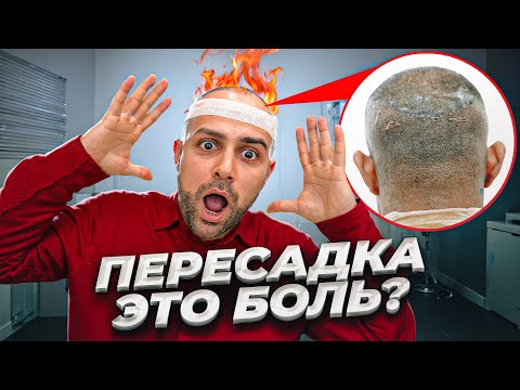 Видео: БОЛЬНО ЛИ ДЕЛАТЬ ПЕРЕСАДКУ?