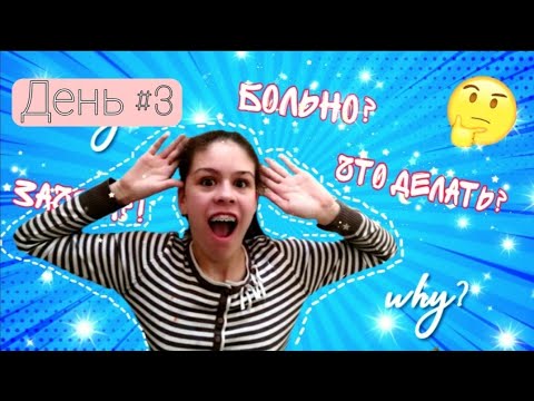 Видео: Железная неделя/брекеты день #3