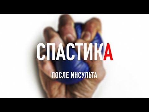 Видео: Спастика после инсульта. Часть 1.