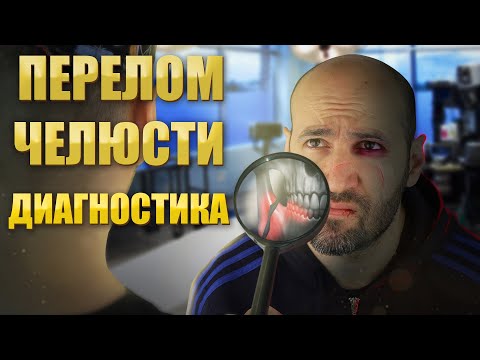 Видео: Все о диагностике переломов нижней челюсти.