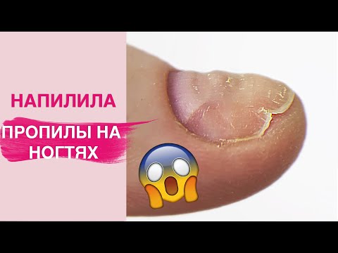 Видео: НАПИЛИЛА 🤦🏻‍♀️| Последствия Аппаратного маникюра