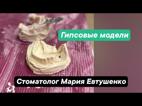 Видео: Гипсовые модели! Как они делаются!) Стоматолог Мария Евтушенко. Москва.