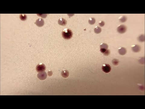 Видео: Стрептококки и энтерококки. Всё сложно? Или нет?)