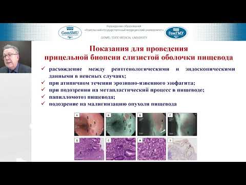 Видео: Козловский А.А. Гастроэзофагеальная рефлюксная болезнь у детей