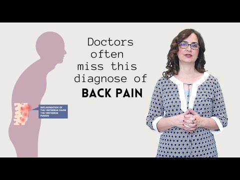 Видео: Почему анкилозирующий спондилоартрит остается незамеченным врачами и как его лечить.