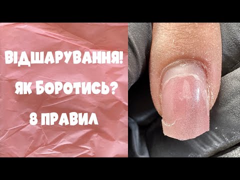 Видео: ВІДШАРУВАННЯ гель лаку, 8 ПРАВИЛ нанесення ідеального і стійкого манікюру 💪❤️