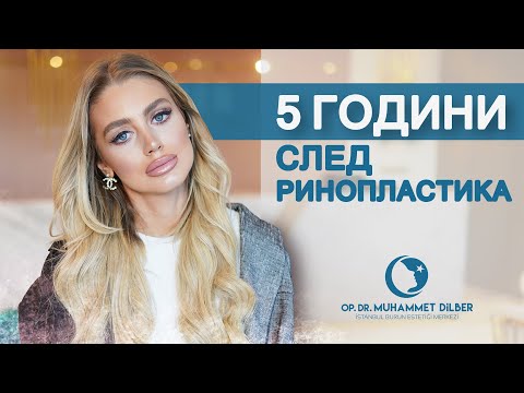 Видео: 5 години след ринопластика