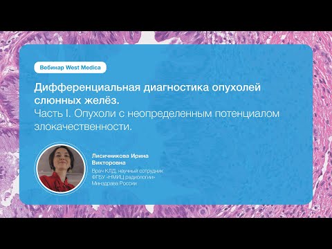 Видео: Дифференциальная диагностика опухолей слюнных желёз. Часть 1 | Вебинар West Medica