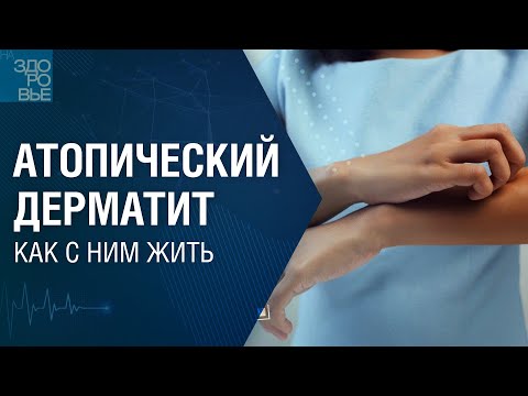 Видео: Атопический дерматит. Как с ним жить 04.06.2022