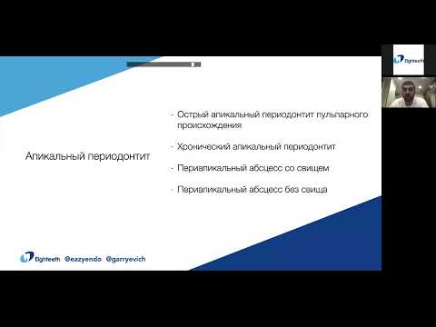 Видео: Вебинар на русском языке- Юрий Кочаров- Тема: Эндодонтическое лечение при периодонтите