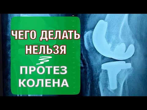 Видео: Пожизненные ограничения.Протез колена. Knee Replacement. What you CAN'T Do After Surgery (Eng. subt)