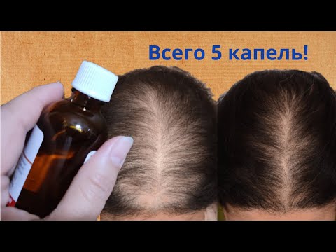 Видео: Укрепить волосы! Всего 5 капель этого средства вместо дорогой косметики от выпадения волос!