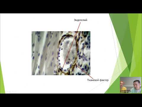 Видео: Вязкоэластические тесты  кому и зачем