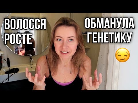 Видео: Як я перемогла алопецію: Міноксидил, біотин, розмарин і секрети густого волосся!