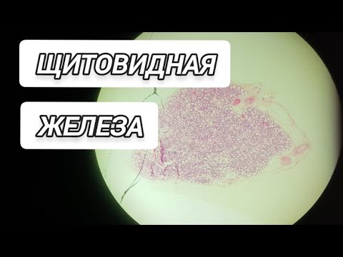 Видео: ЩИТОВИДНАЯ ЖЕЛЕЗА