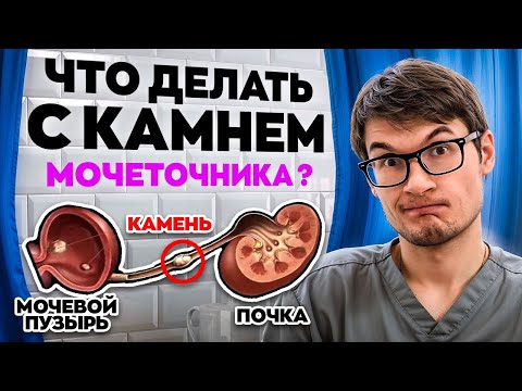 Видео: Что делать с камнем мочеточника?