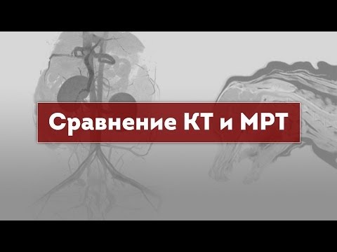 Видео: Компьютерная томография, МРТ. Сравнение