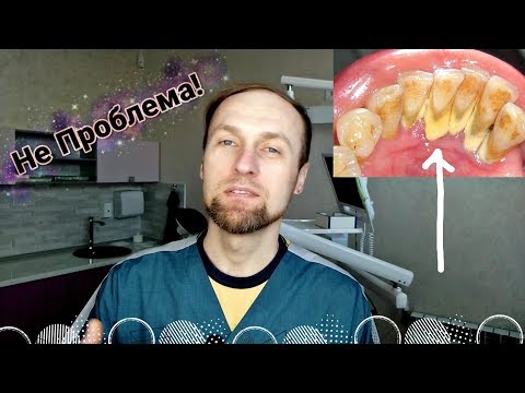 Видео: Зубной Камень Больше Не Проблема!