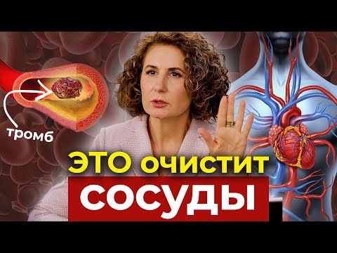 Видео: ТЫ ПРОЖИВЁШЬ МЕНЬШЕ, если у тебя есть ЭТА ПРОБЛЕМА с сосудами!