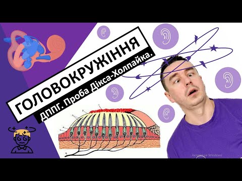 Видео: ГОЛОВОКРУЖІННЯ та запаморочення. ДППГ. Проба Дікса-Холпайка. Маневр Еплі. #головокружіння