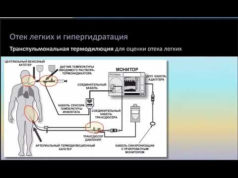 Видео: Гипергидратация и отек легких Кузьков В.В.