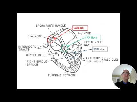 Видео: Ходунов О.Б. Брадиаритмии: блокады сердца, дисфункция синусового узла