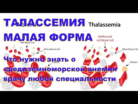 Видео: Талассемия, малая форма. Что нужно знать о средиземноморской анемии врачу любой специальности