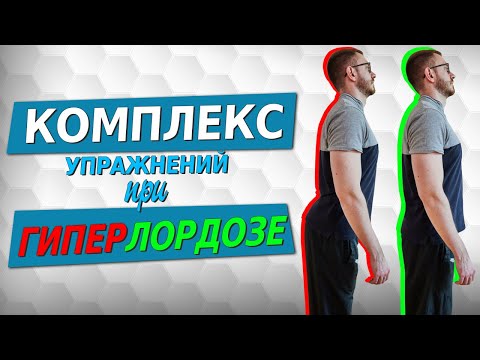 Видео: Комплекс упражнений при поясничном гиперлордозе.