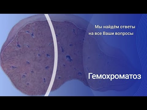 Видео: Гемохроматоз