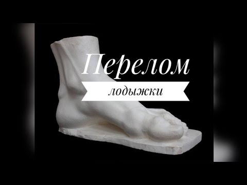 Видео: ПЕРЕЛОМ ЛОДЫЖКИ.ЧТО ДЕЛАТЬ?ПОЛИМЕРНЫЙ ГИПС.ДЕЛЮСЬ ОПЫТОМ