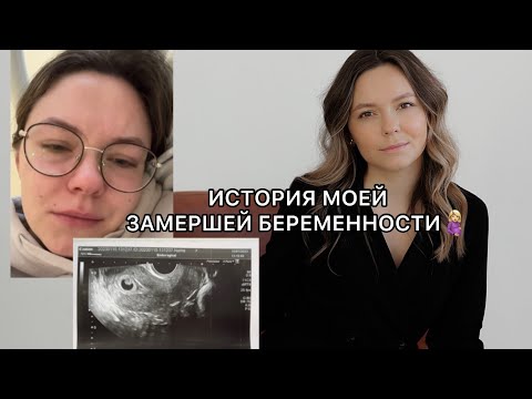 Видео: МОЯ ЗАМЕРШАЯ БЕРЕМЕННОСТЬ на 8 неделе