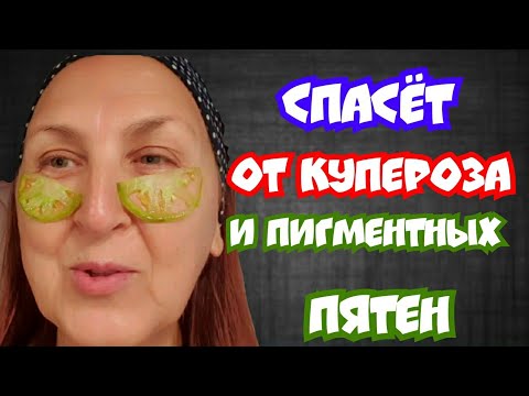 Видео: СПАСЕТ От КУПЕРОЗа и ПИГМЕНТНЫХ ПЯТЕН / Удивительная МАСКА из Зелёных Томатов