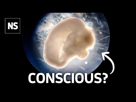 Видео: Мозговые органоиды раскрывают секреты человеческого разума