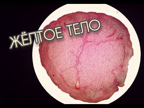 Видео: гистопрепарат ЖЁЛТОЕ ТЕЛО