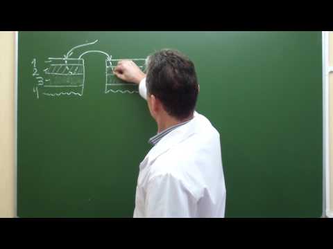 Видео: Схема кишечного шва Ламбера